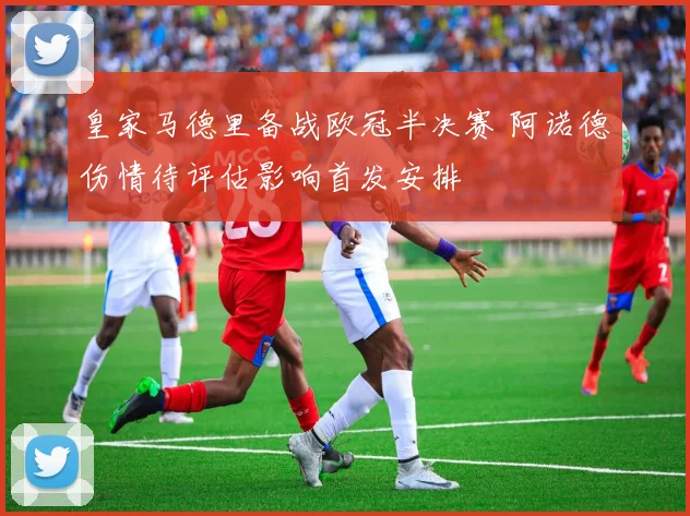 皇家马德里备战欧冠半决赛 阿诺德伤情待评估影响首发安排